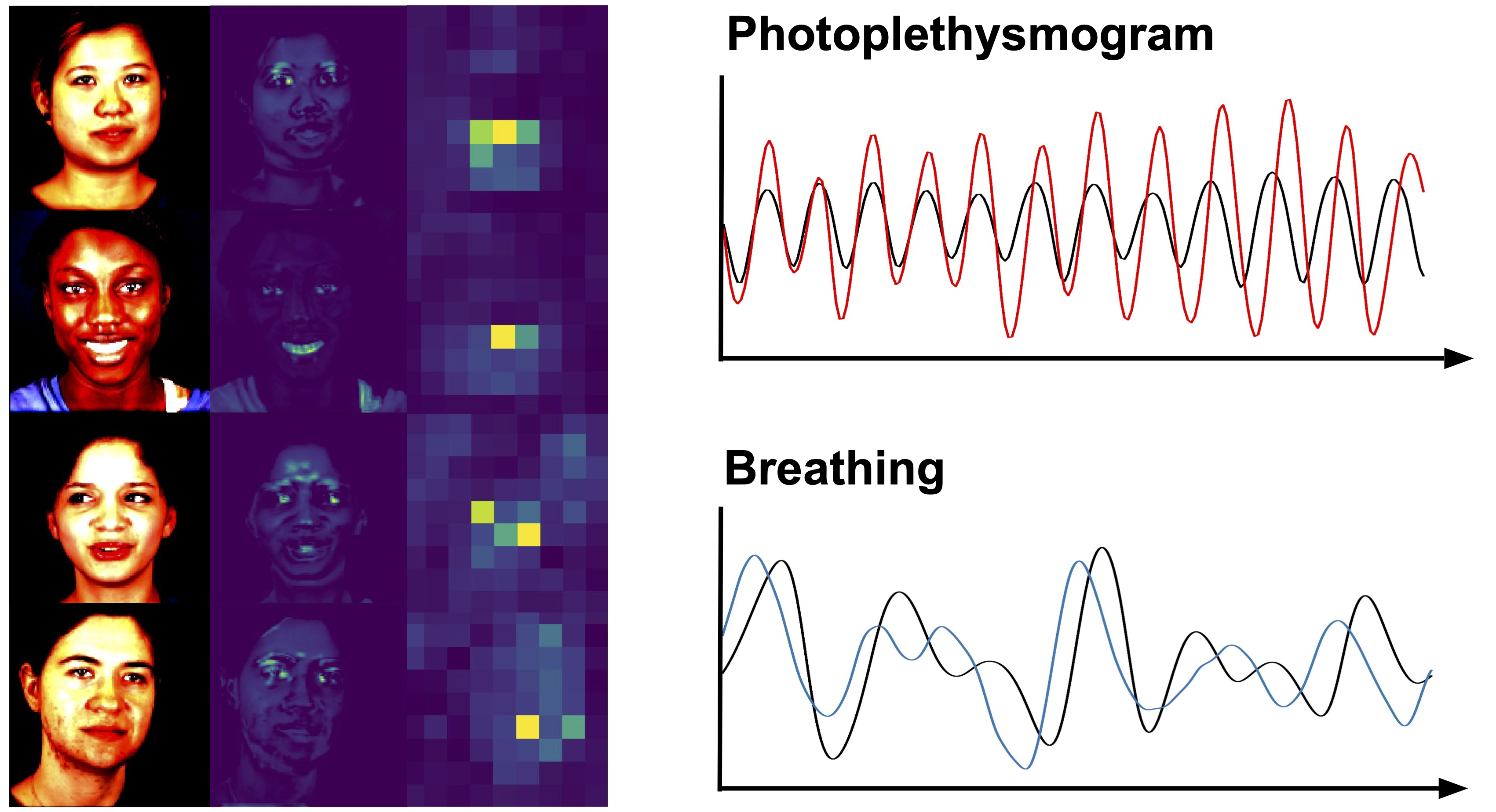 BigSmall: Efficient Multi-Task Learning for Disparate Spatial and Temporal Physiological Measurements
