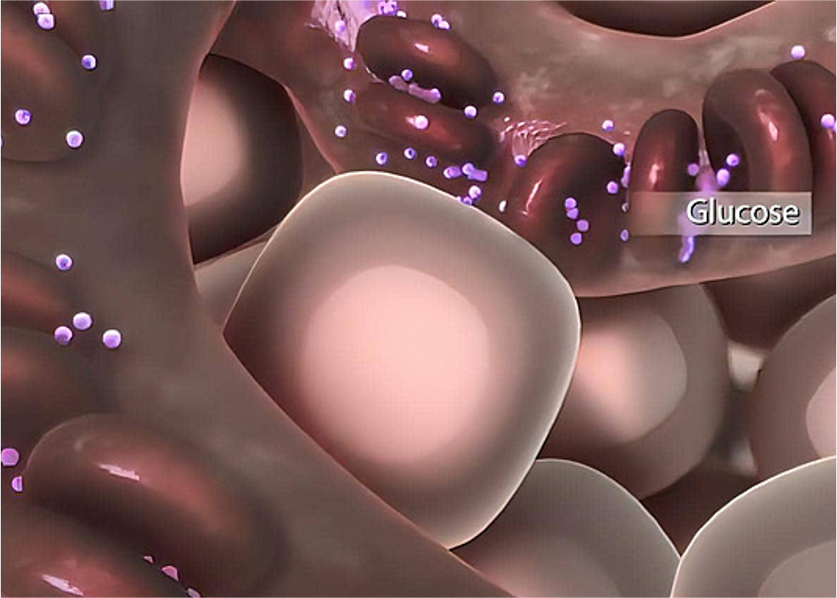 Insulin Resistance Prediction from Wearables and Routine Blood Biomarkers