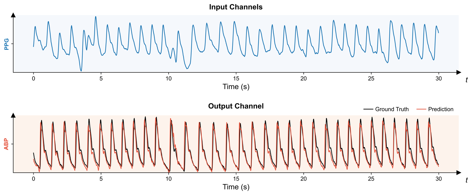 Blood pressure translation example